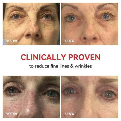 Red Light Therapy Device for Eyes | Reduces Fine Lines, Promotes Collagen & Effortless 3-Minute Daily Routine