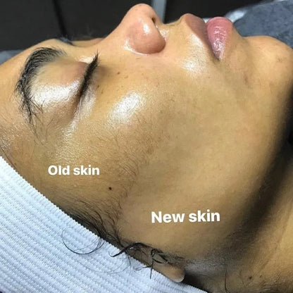 Sonic Dermaplaning Device | Microfine Edges for Smooth Skin & Enhanced Skincare Absorption