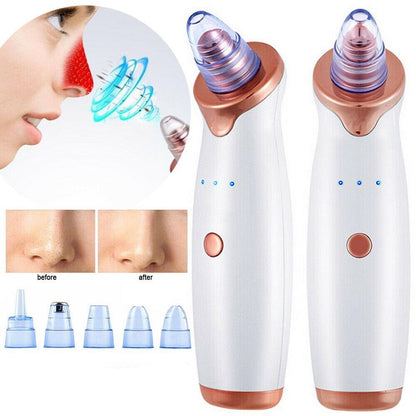 Blackhead Vacuum Remover Microdermabrasion Technology