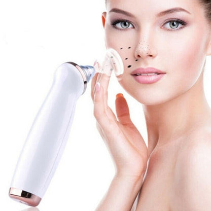 Blackhead Vacuum Remover Microdermabrasion Technology